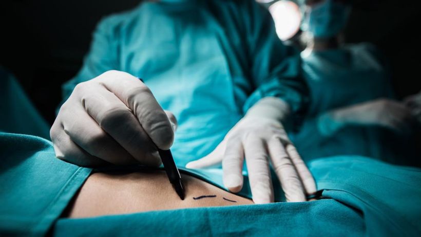 UK Cosmetic Surgery Company The Hospital Group Targeted by REvil Hackers